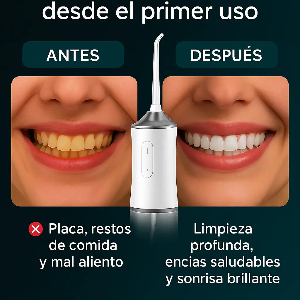¡OFERTA!  Hidro Dental Irrigador Bucal Profesional - Limpieza Profunda + Envío Gratis